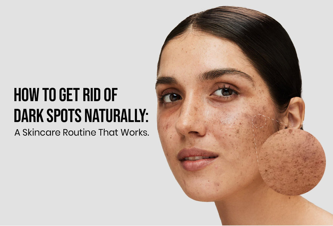 How to Get Rid of Dark Spots Naturally : A Skincare Routine That Works