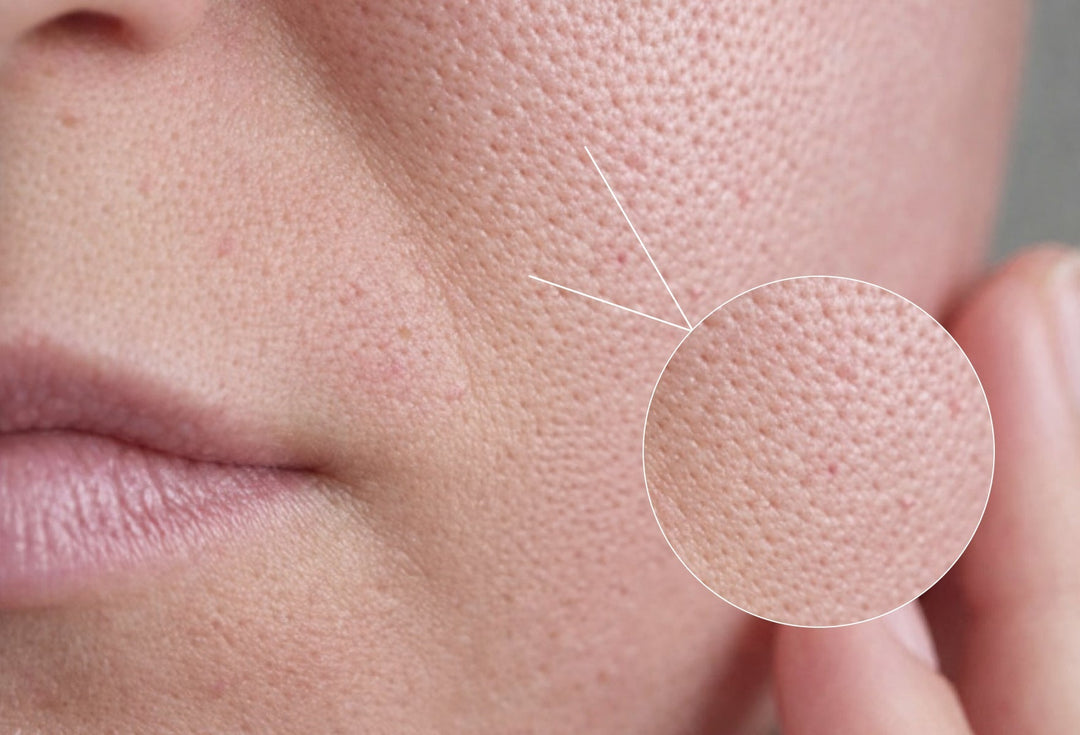 Skincare Routine for Open Pores: Step-by-Step Guide.