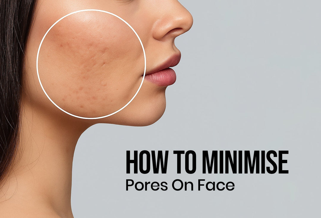 How to Minimise Pores on Face Naturally: Tips for Smooth, Healthy Skin