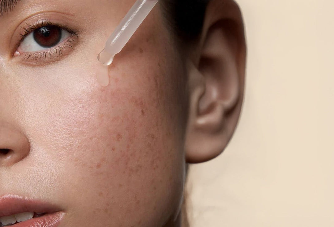 Salicylic Acid Uses For Skin: Benefits & Uses