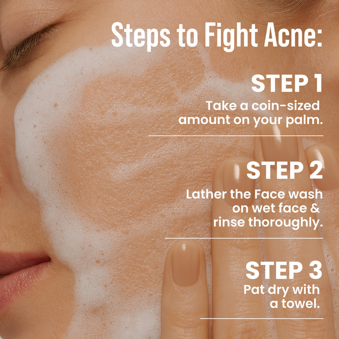 Salicylic Acid Face Wash For Acne & Pimple