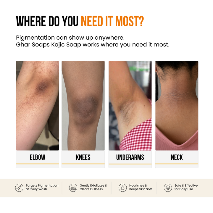 Kojic Acid Soap for De-Pigmentation & Dark Spot Reduction