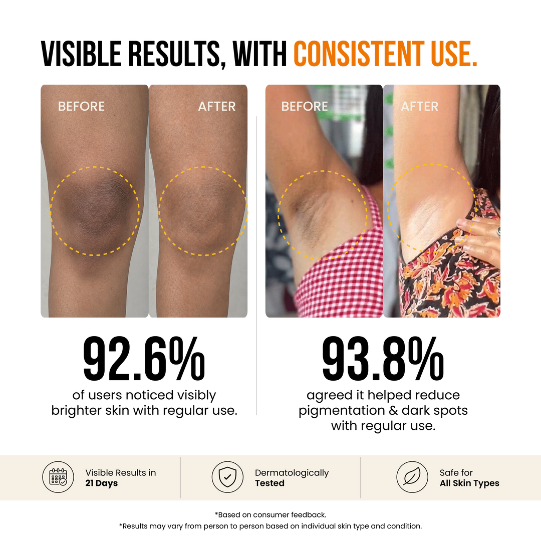 Kojic Acid Soap for De-Pigmentation & Dark Spot Reduction