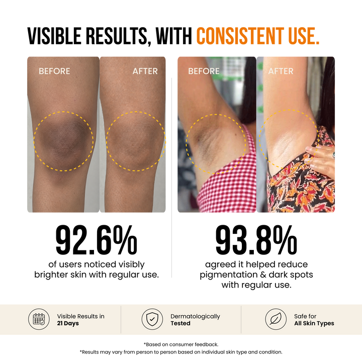 Kojic Acid Soap for De-Pigmentation & Dark Spot Reduction